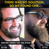 Mega Beard Growth Oil 2-Pack + FREE Beard Roller Derm Dude
