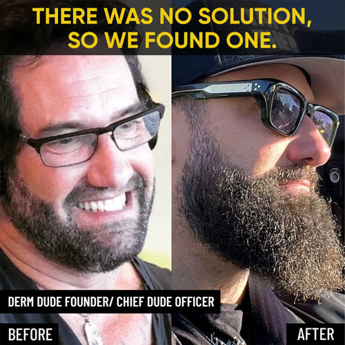 Mega Beard Growth Oil 2-Pack + FREE Beard Roller Derm Dude